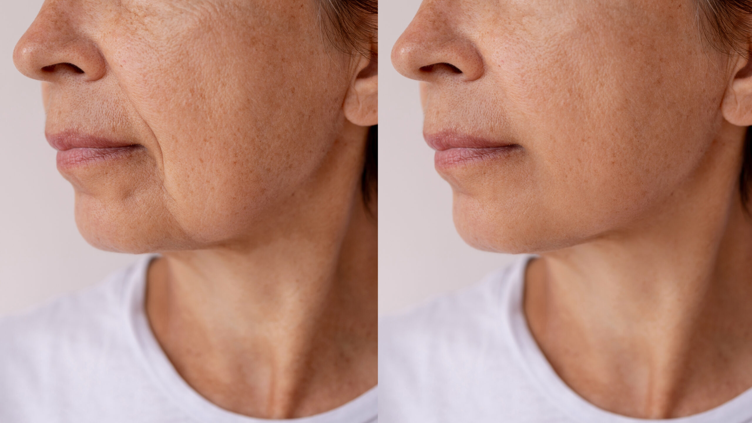 Scarlet Pro before and after result